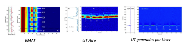 tecnicas ultrasonido